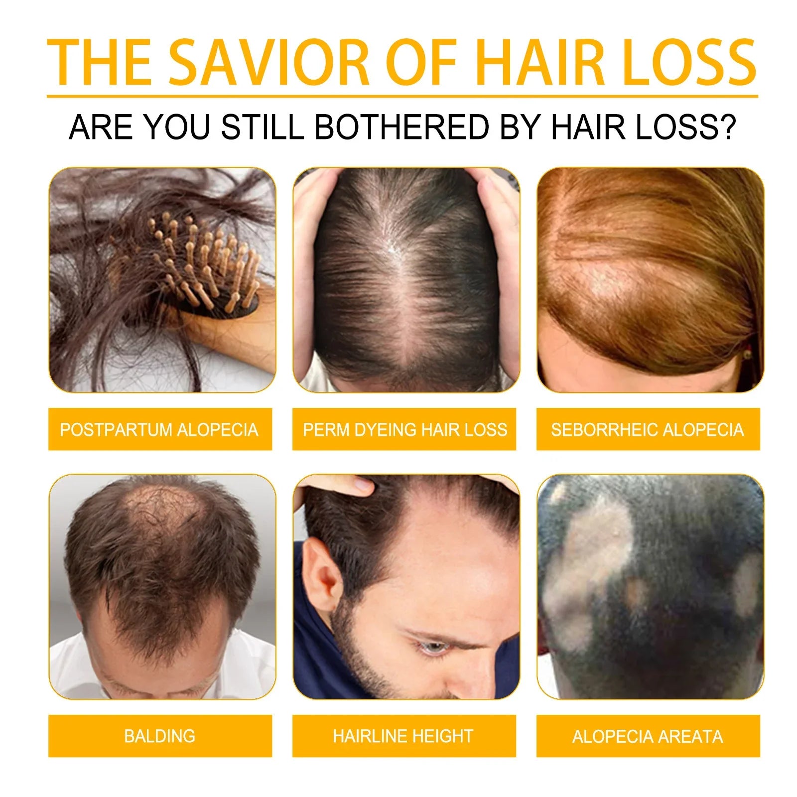 Hair loss types illustration with photos of balding, alopecia, receding hairline, and hair shedding issues.