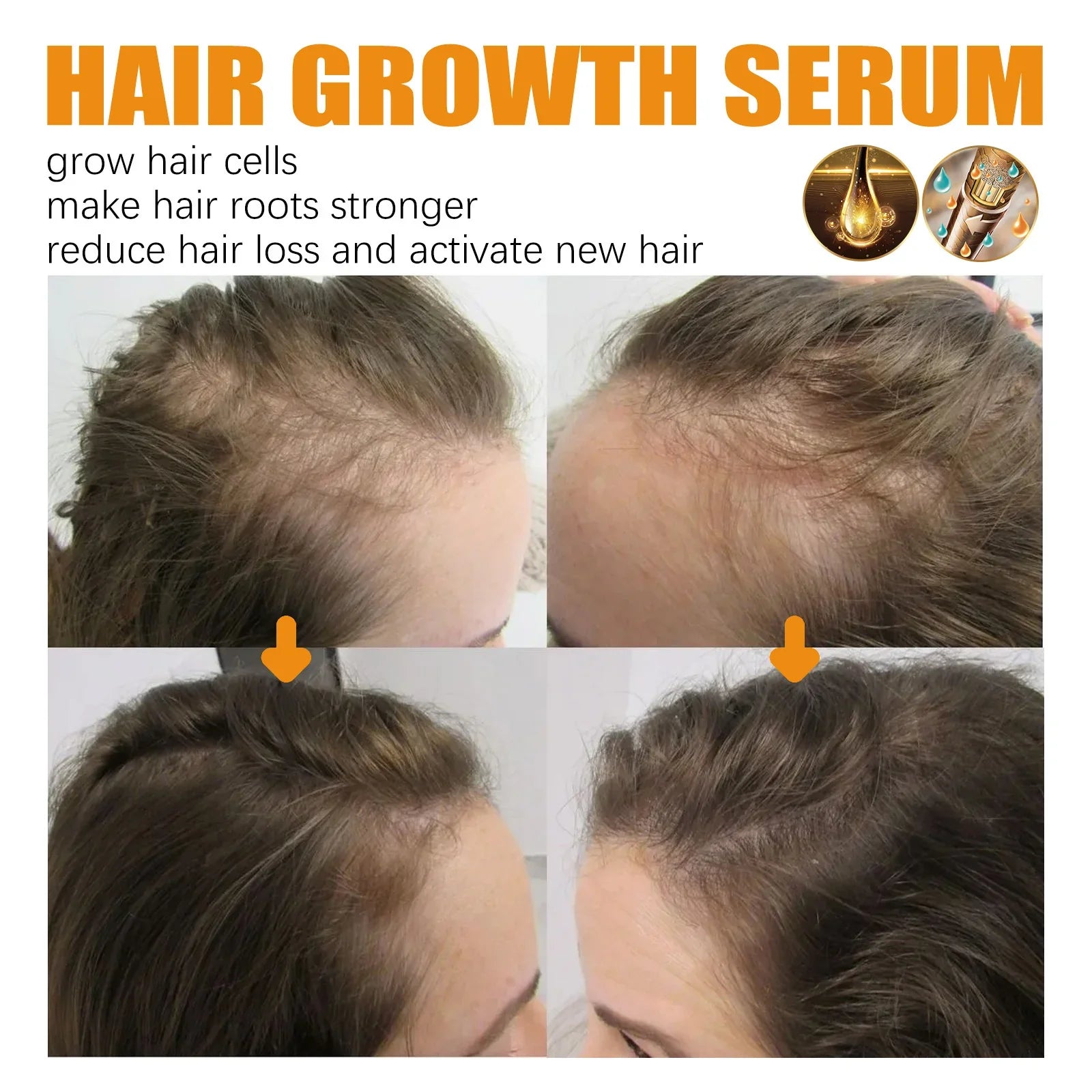 Hair growth serum before and after results on thinning hair, hairline improvement shown.