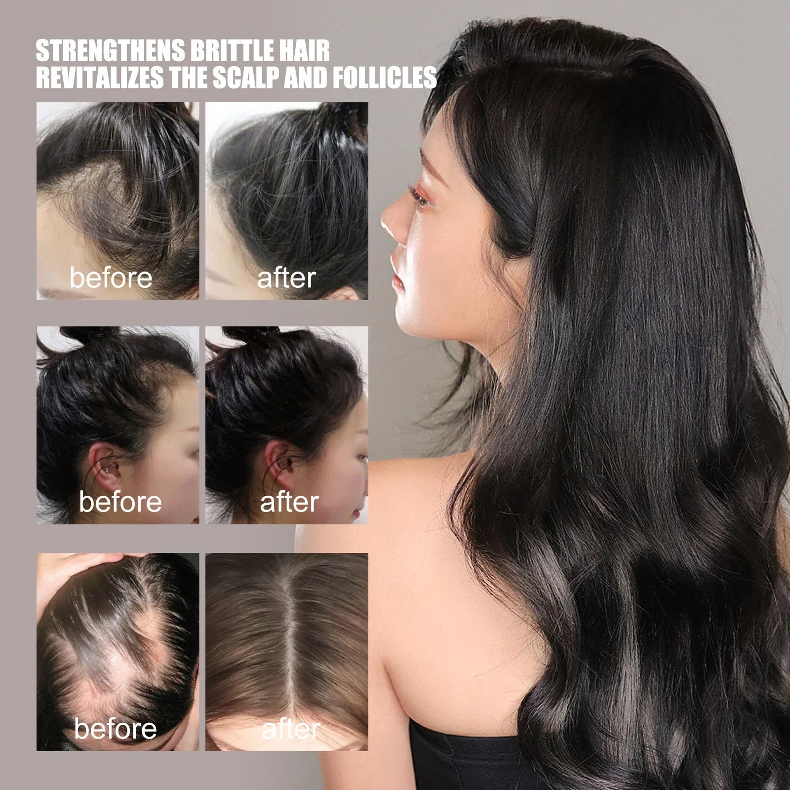 Before and after hair growth results showing thicker, healthier hair and improved scalp.